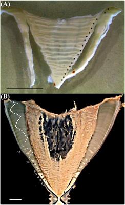 Annual Bands in Vertebrae Validated by Bomb Radiocarbon Assays Provide Estimates of Age and Growth of Whale Sharks